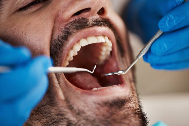 Best Wisdom Tooth Removal  in Sterling, IL